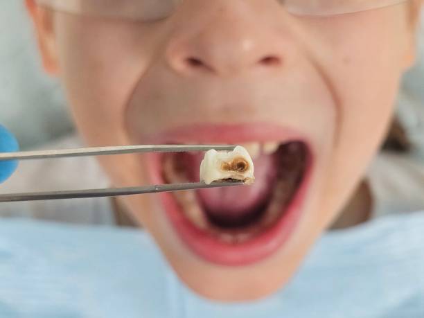 Best Orthodontic Emergency Dentist in Chillum, MD